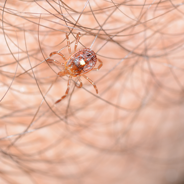 All About Alpha-Gal Syndrome & Tick Control in Waukesha County