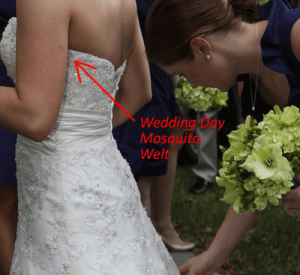 Don't Let Mosquitoes Ruin Your Special Day