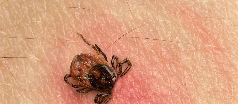 Massachusetts State Health Officials Reject CDC’s Lower Lyme Numbers