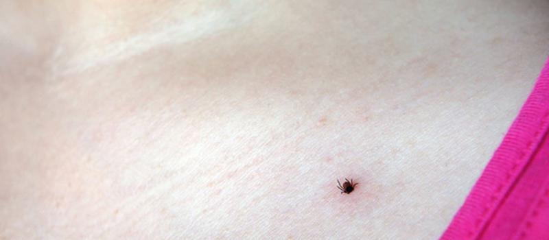 Is Massachusetts the land of tick-borne illness?