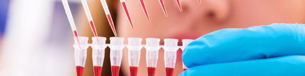 Dengue Fever Outbreak: Assessing the Risk in Southeastern Mass