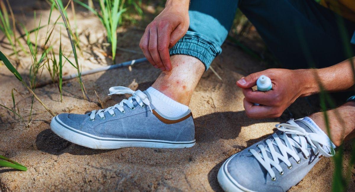 What Happens When a Flea Bites a Human?