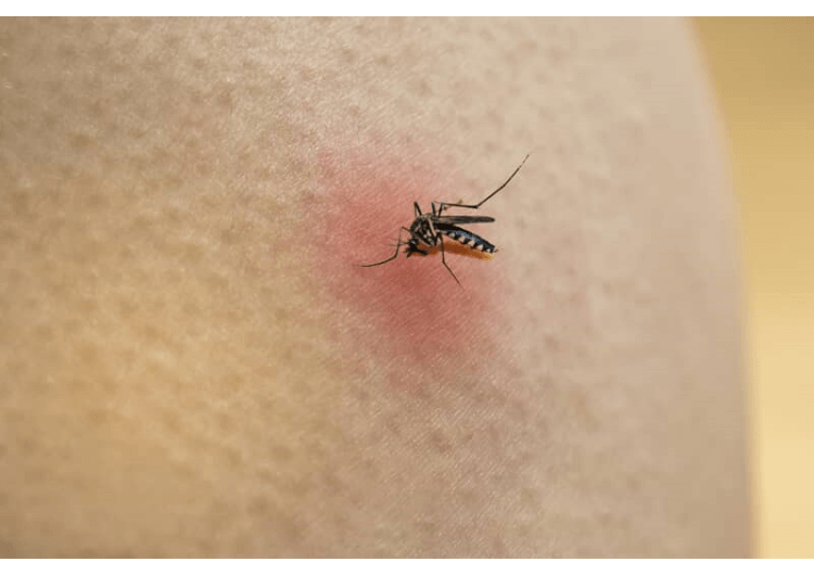 mosquito biting person
