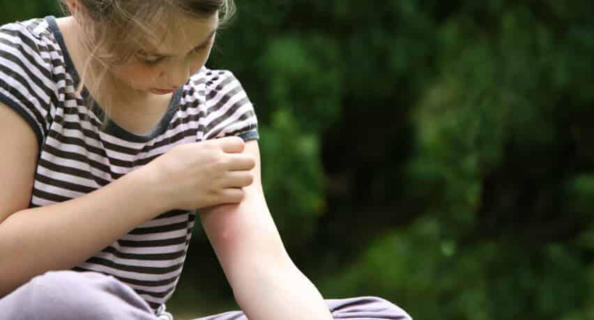 Child itching a mosquito bite.