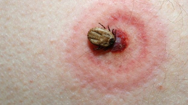 Tick Protection in Springfield, MA