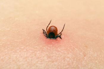 Tick in skin 