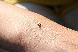 tick on skin 