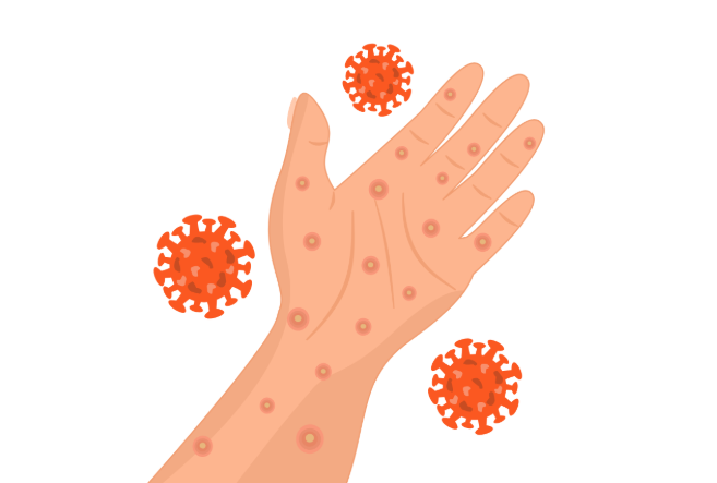 Should You Worry About Mosquito Bites in Charlottesville, VA?