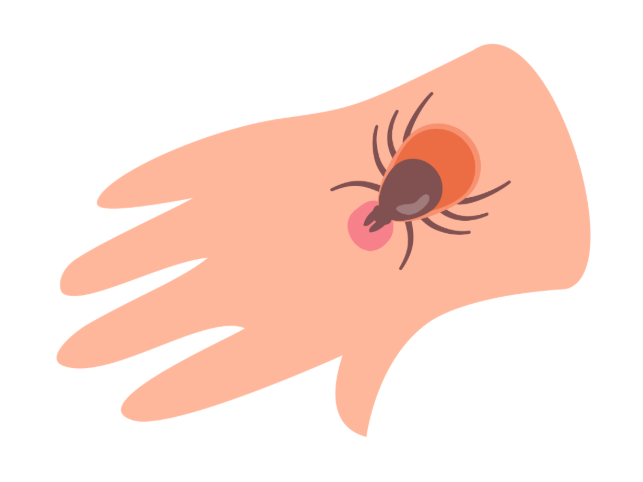 Risk Factors for Tick Bites in Kansas City