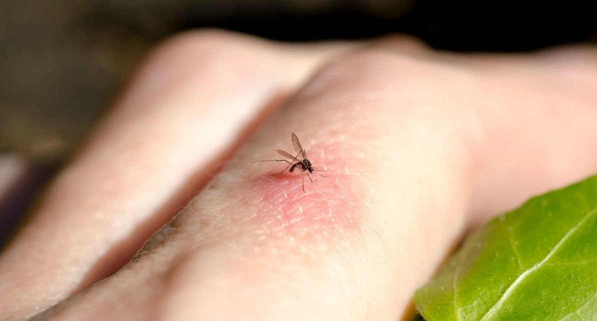 What’s Biting Me in My Backyard During the Day?