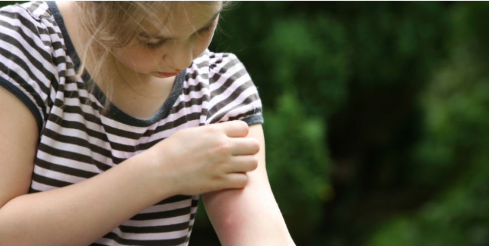 Helping Protect Kids from Mosquito Bites During Summer Break