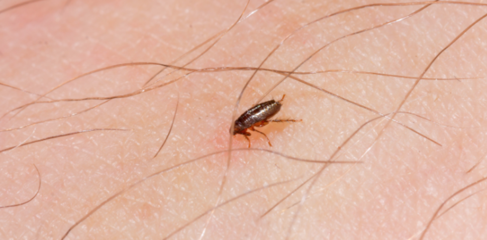 Why Flea-Borne Typhus Is a Current L.A. County Concern