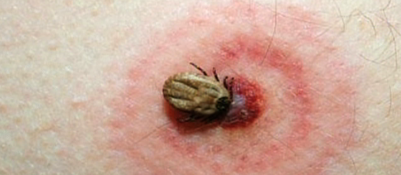 The Truth About Ticks