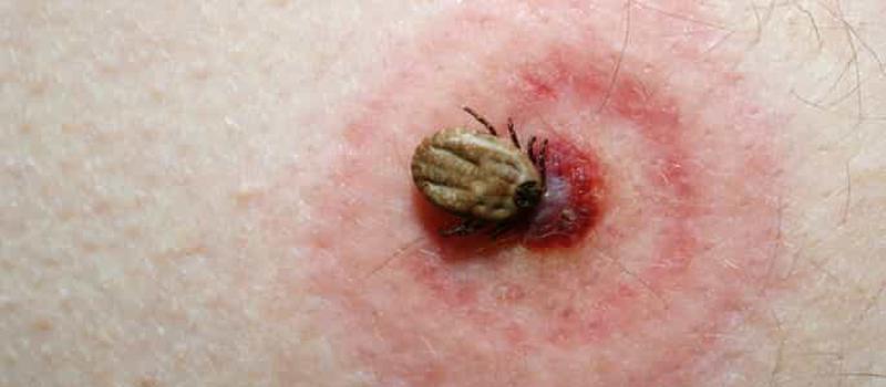 Is the New Tick Disease, Heartland Virus in NJ?