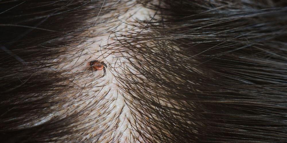 tick in hair