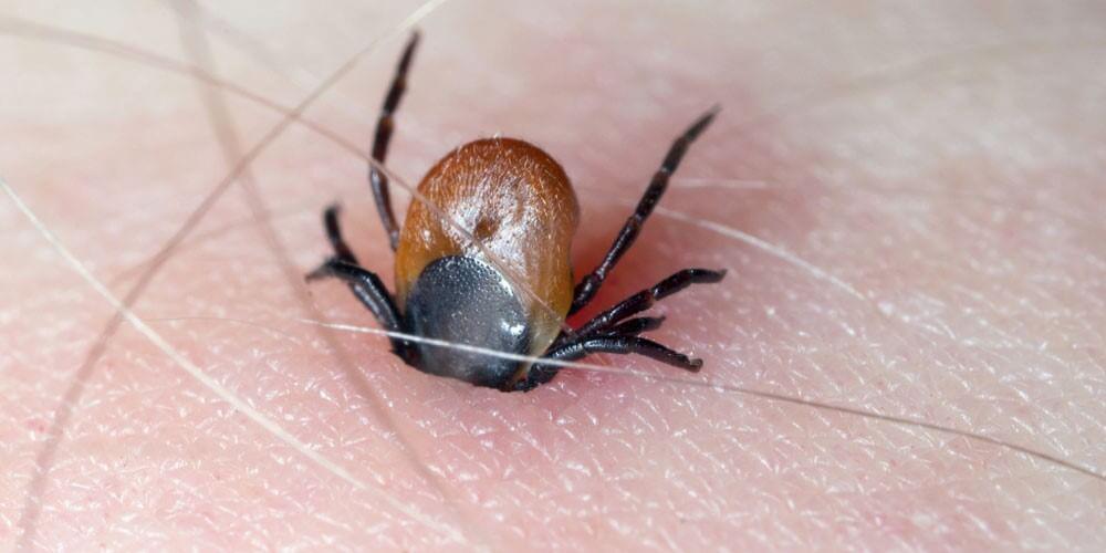 tick in skin 