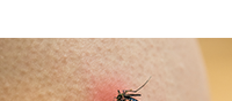 Treating Itchy Mosquito Bites